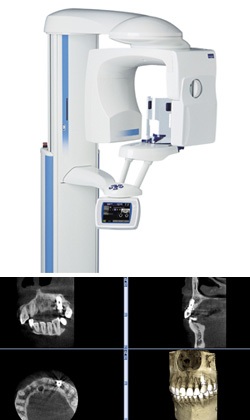 高精度X線CT撮影装置